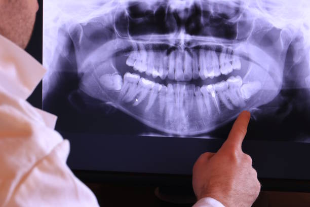 Best Emergency Dentist for Lost Fillings or Crowns in Roebuck, SC